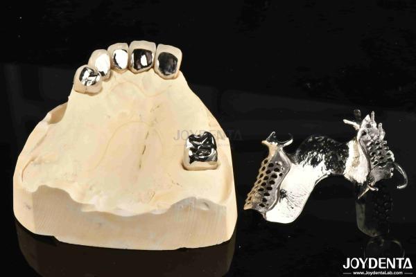 Alloying Metal Dental Framework Removable Wearable For Dental Practitioners