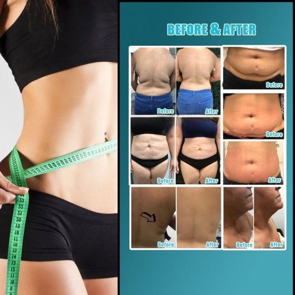 Вакуумный ролик Vela Slimming Machine Потеря веса и скульптура тела