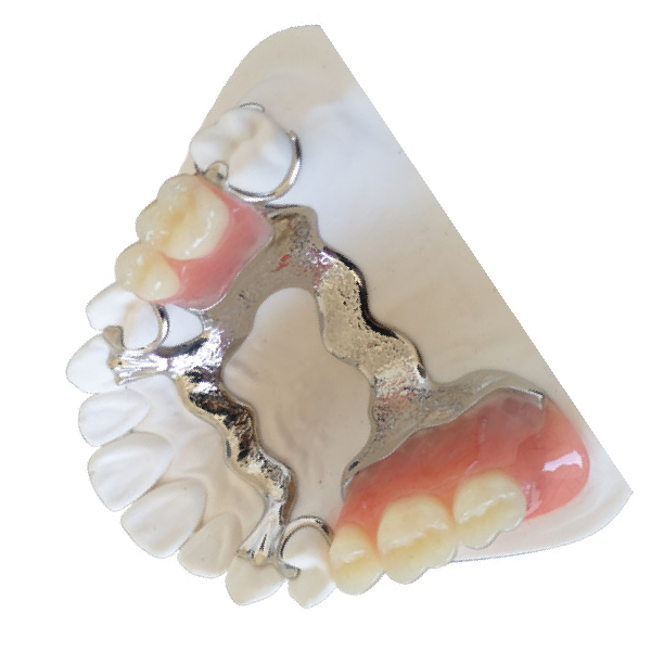 Мост высокое биологическое Intermiscibility кроны принтера PFM OEM 3D зубоврачебный