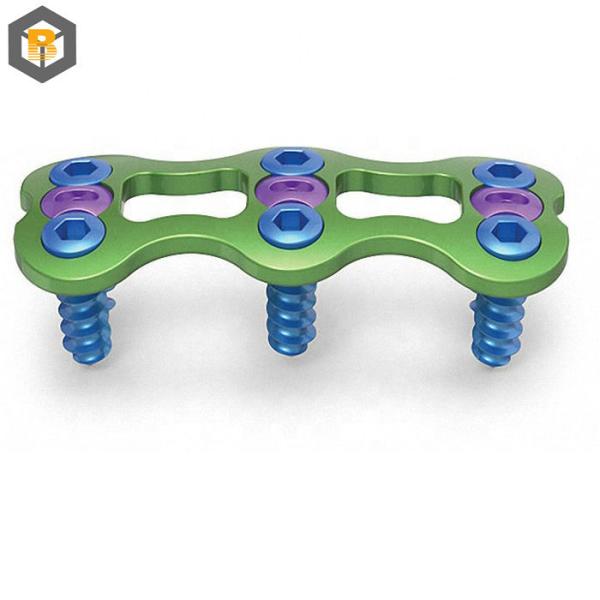 Customized by 2D/3D/Drawing Instruments Top Selling Orthopedic Implant Cortical Screw