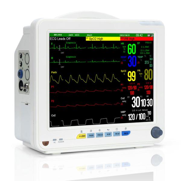 12in Hospital Vital Sign Patient Monitor 800×600 DPI ICU ETCO2
