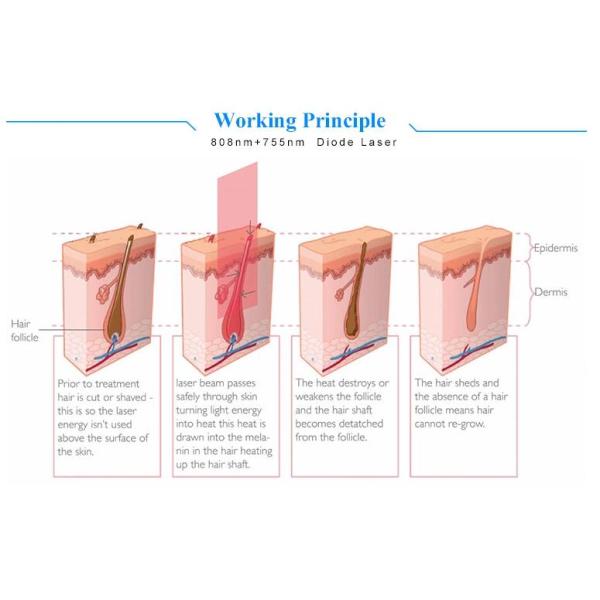 оборудование удаления волос диода результата 810нм профессиональной машины ипл хорошее