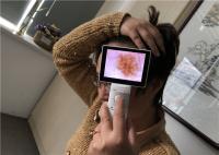 Endoscope OTO-RHINO visuel de Dermatoscope USB de caméra facultative de peau de Wirelesss avec 3,5 pouces TFT LCD coloré
