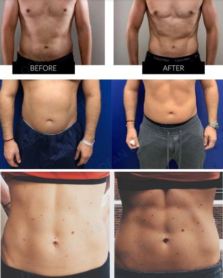 УПРАВЛЕНИЕ ПО САНИТАРНОМУ НАДЗОРУ ЗА КАЧЕСТВОМ ПИЩЕВЫХ ПРОДУКТОВ И МЕДИКАМЕНТОВ машины стимулированием мышцы HIEMT EMslim электромагнитное для формировать тела