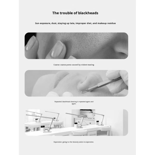 Facial Blackhead Remover Cleaning Device Vacuum Adsorption Technology For Deep Pore Cleansing Effectively Removes Stubborn Blackheads And Whiteheads