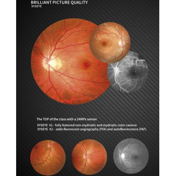 Управление машины 35mm камеры фотографии Fundus цифров эффективное результатов