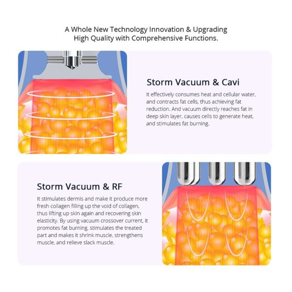 Rf 40k Ultrasonic Fat Cavitation Machine Cavstorm 3.0 Vacuum Cup Weight Loss
