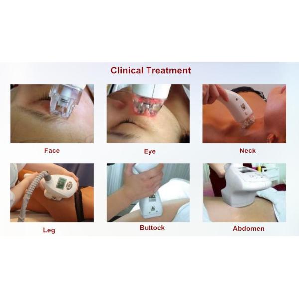 Vacuum + Bipolar RF +940 Near Infrared + Roller + liposuction Ultrasonic cavitation beauty