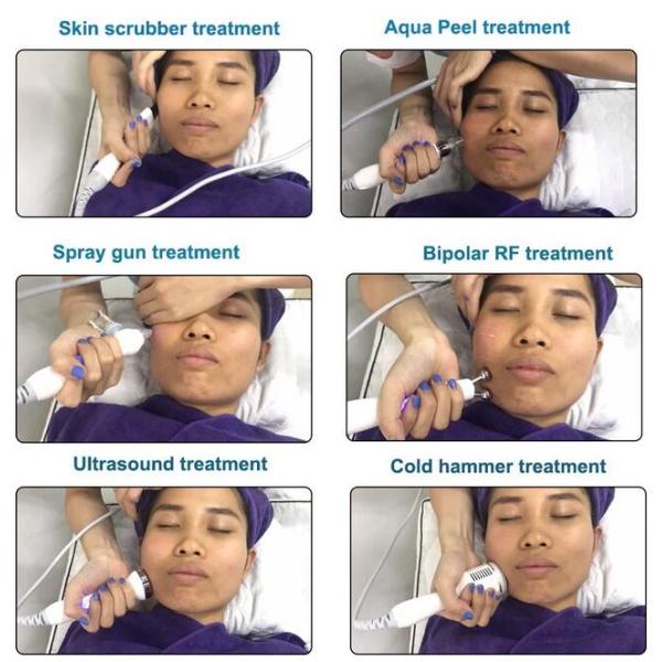 6 In 1 Hydrafacial Machine / Hydro Microdermabrasion Machine For Any Skin