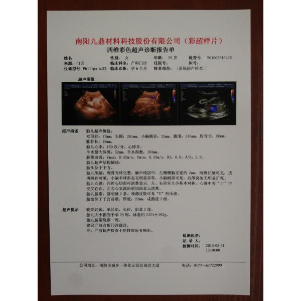 A4 Duplex Printing Medical Laser Film White Base Laser Printer X Ray Film