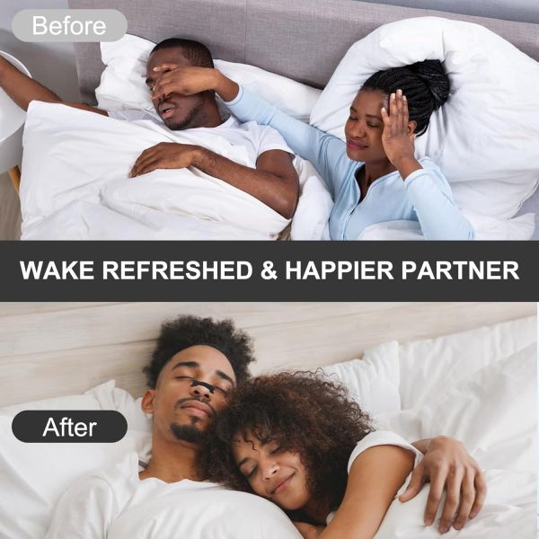 Cross-Border Strong Adhesive Brown Nose Breathing Strips Anti-Snoring Devices to Improve Sleep Ventilation