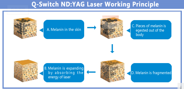 Combined e-light nd yag laser hair removal settings , skin care machine