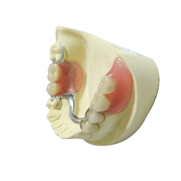 Dentures здоровой лаборатории Denture материалов зубоврачебной съемные частично выполненные на заказ