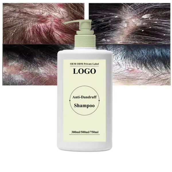 Controlo de óleo Shampoo anti caspa Anti-coceira Shampoo de limpeza profunda Shampoo capilar