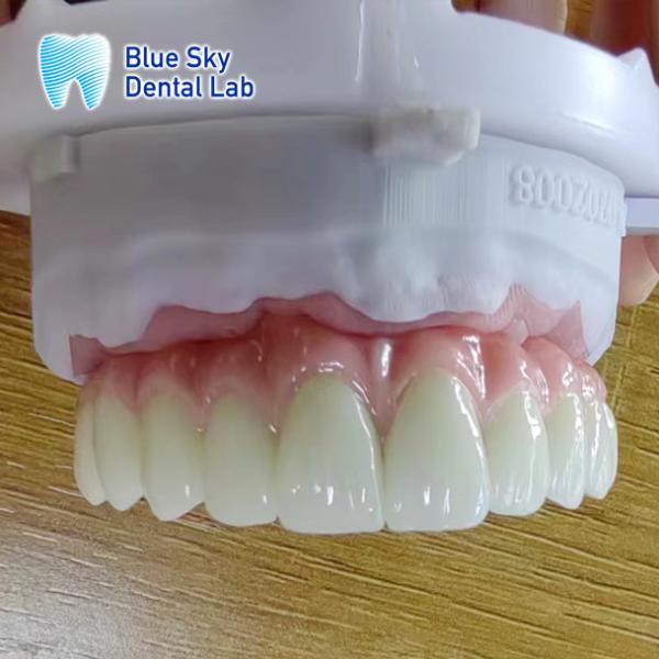 Nature Dental Implant Cases Smooth Full Mouth Implant Case For Implant System