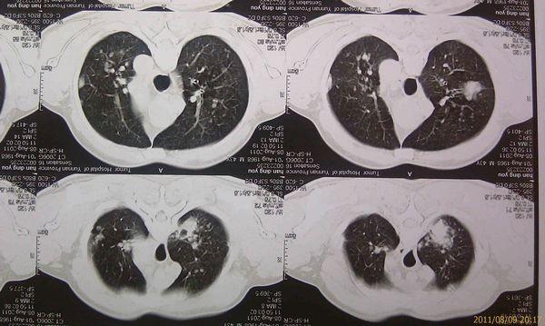 Eco-Friendly Medical Dry Film Agfa 2B X Ray With CT Machine