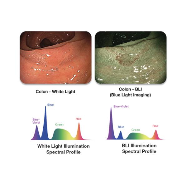 Système d'imagerie endoscopique Fujifilm ELUXEO Lumière Blanche Supérieure