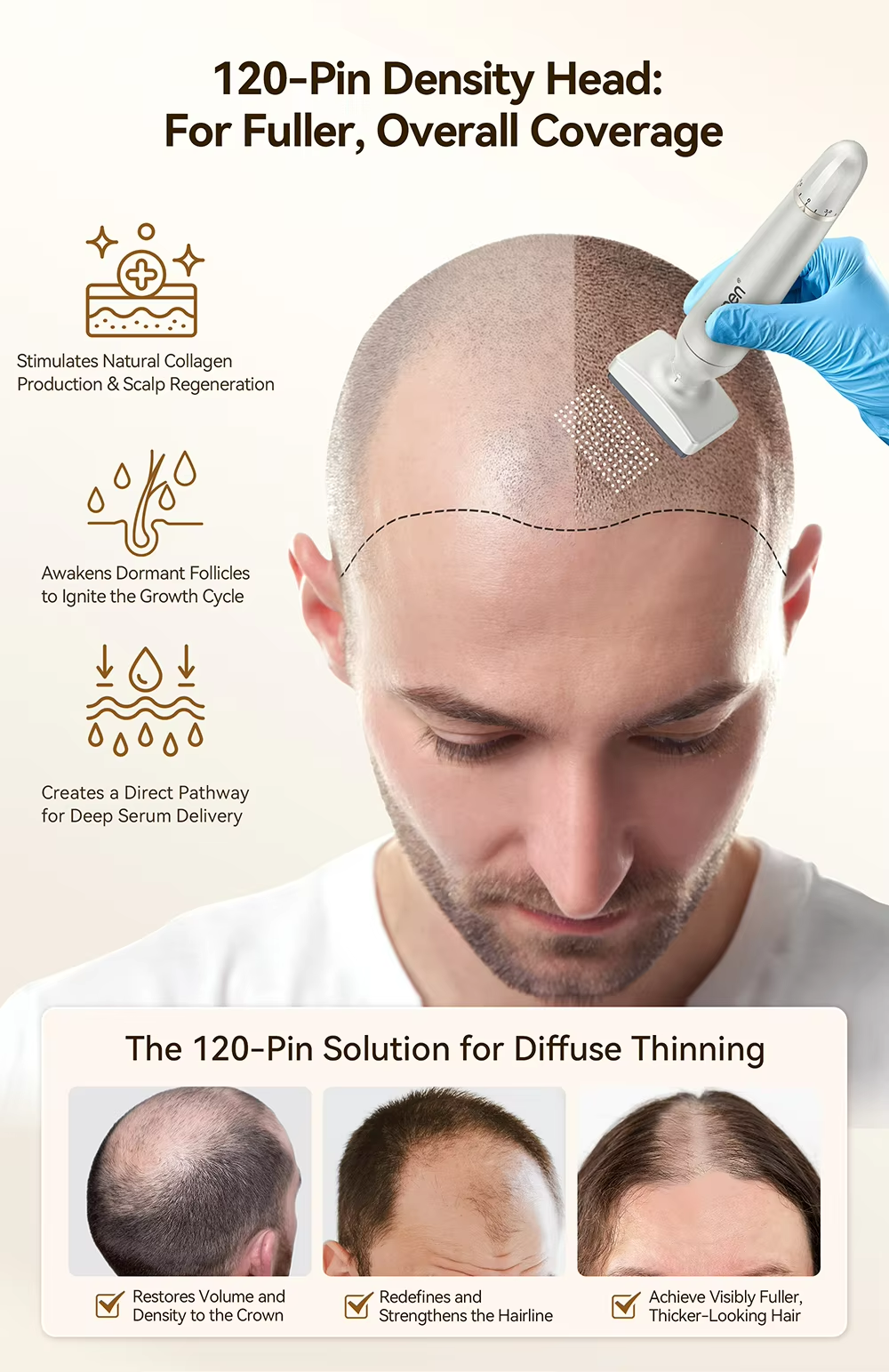 Bio4 Professional Microneedling Derma Pen with Four-Level Adjustable Microneedling 120 Pins and Stainless Steel/Titanium Needles for Precise Skincare