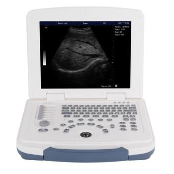 ON SALE!!!  Portable full digital laptop B&W ultrasound scanner for hospital
