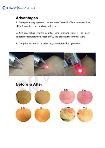 Professional manufacturer 980 nm laser diode machine for skin tags / vascular veins removal