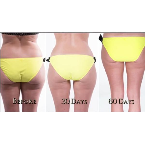 Vertical cryo fat freeze machine weight loss cryo fat freeze slimming machine