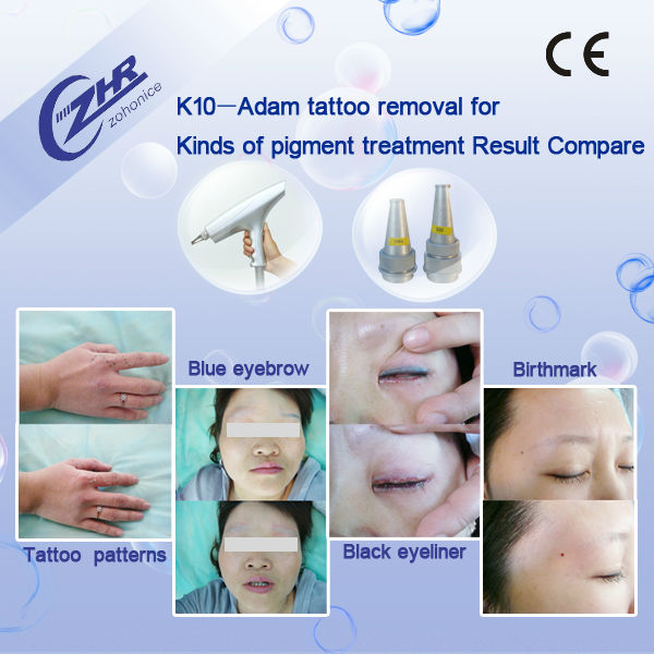 Лазер Yag удаления пигмента машины ластика татуировки заботы кожи портативный