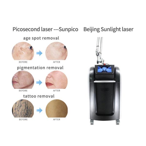 Ultra - Short Pulses Picosecond Laser Tattoo Removal Machine 1064nm / 532nm / 755nm