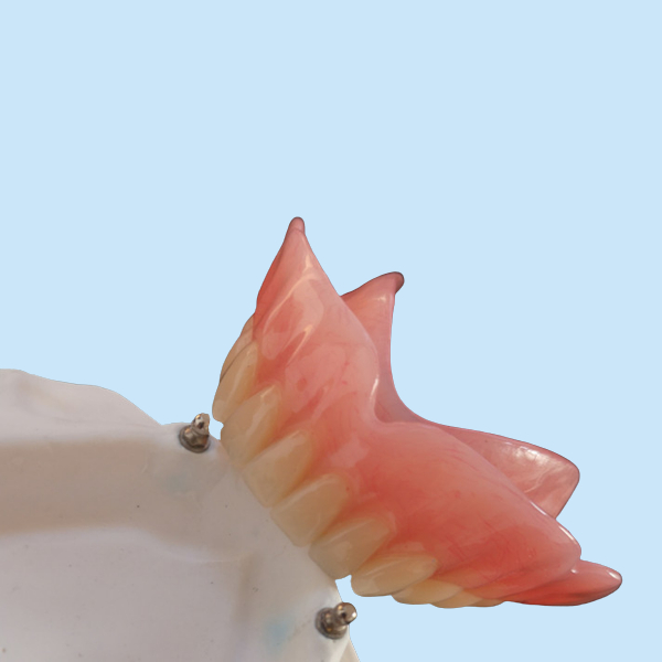 Высокий Denture CAD-CAM приложения точности Biocompatibility имплантирует