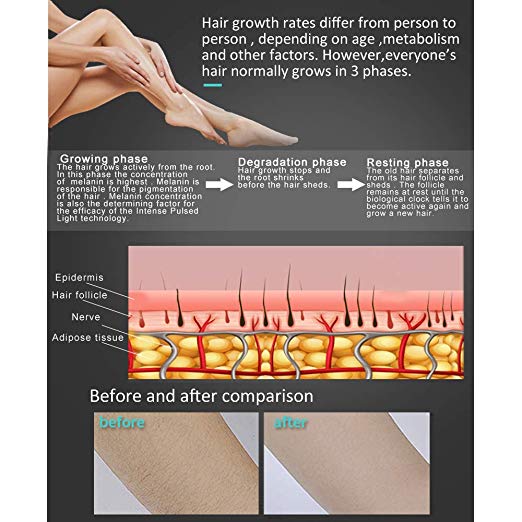 Fda Approved Laser Hair Removal Machines Electric Threading Epilator Equipment