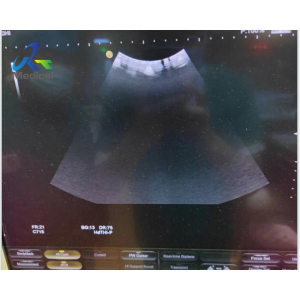 Medical Ultrasound Equipment Repair Hitachi HI VISION Avius Bright Channels Faulty
