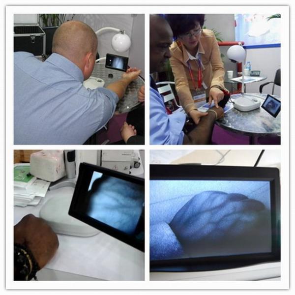 5 детектора вены экрана дюйма Б/В искатель вены гибкого портативного ультракрасный для медсестер и докторов