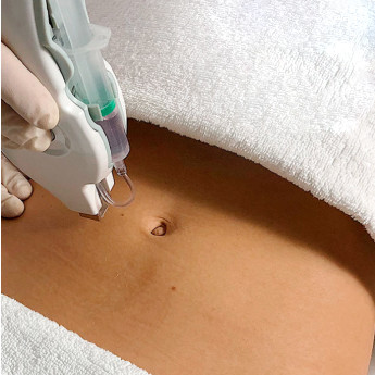 Professional RF Meso Machine With Advanced Technology And LCD Screen OEM/ODM customized brand