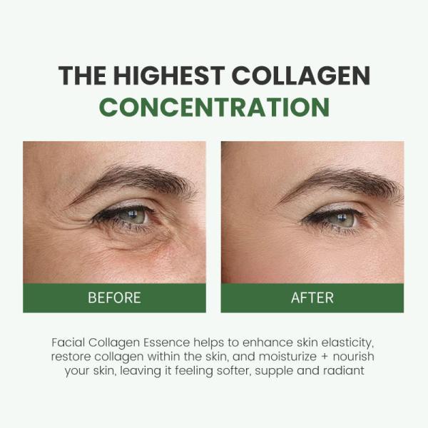 Serum de colágeno facial puro Antirrugas Serum antienvelhecimento Colágeno Facial Essence Liquid