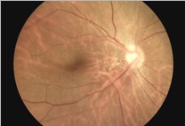 Камера Fundus изображений и видео магазина портативная