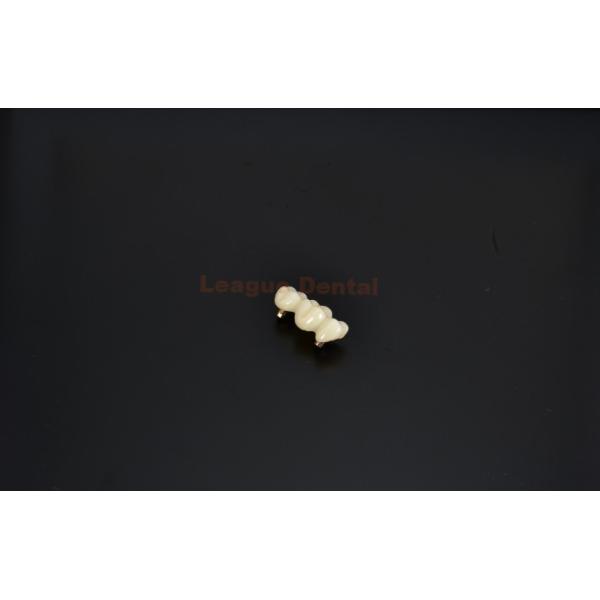 Glazed Cement Retained Implant Crown High Strength Implant Cemented Crown