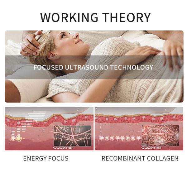 HIRONIC Ultra Private Rejuvenation HIFU Skin Tightening Machine With 2 Cartridges