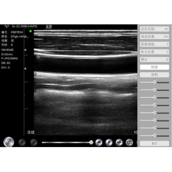 El equipo Doppler de mano del ultrasonido de Doppler trabaja a máquina 128 elementos 90~200m m que la profundidad 235g carga la conexión de Wifi