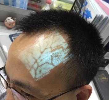 Veias infravermelhas profissionais médicas do achado de Transilluminator do visor da veia para a flebotomia