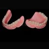 China Dental Lab Digital Full Dentures Using CAD/Cam Technology 3D Printing and Skilled Technicians