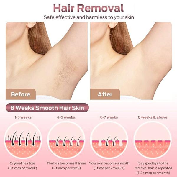 Medical Grade Titanium Diode Laser Hair Removal Machine 4 Waves