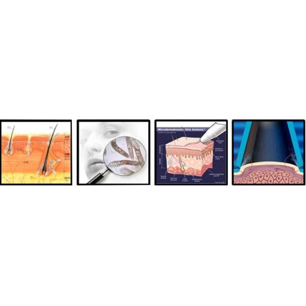 Diamond head replacement skin hydro microdermabrasion facial machine