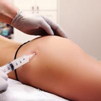 Remplisseurs de lèvres naturels Acide hyaluronique injectable