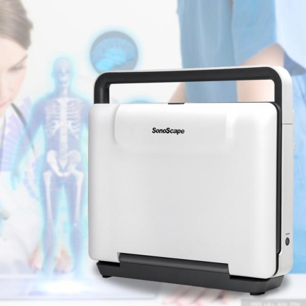 Hot Slaes Ecografo Portatil Sonoscape E2 Ultrasonido Portatil