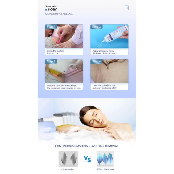 машина обработки выпадения волос машины удаления волос лазера диода 3500В 808 Нм