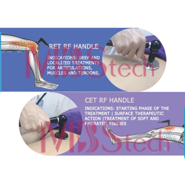 Медицинская машина терапией Tecar