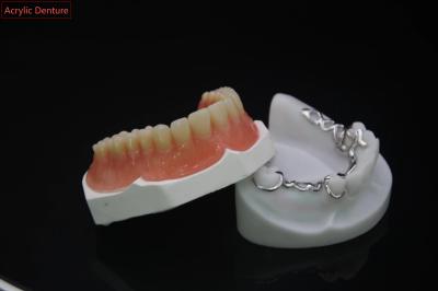 Acrylic Denture