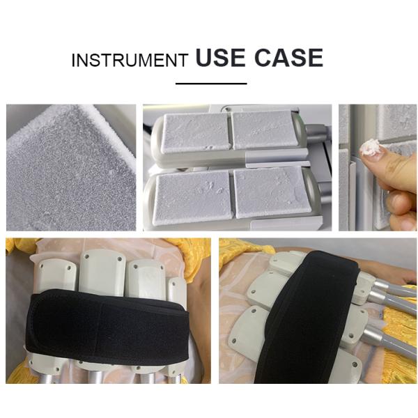 Máquina de adelgazamiento Ems Crioplaca para esculpir el cuerpo Otros equipos de salón de belleza