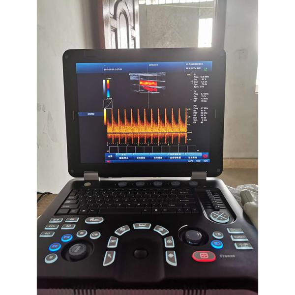 100% Guaranteed Portable Color Doppler Ultrasound Echocardiography Echo Ultrasound Machine