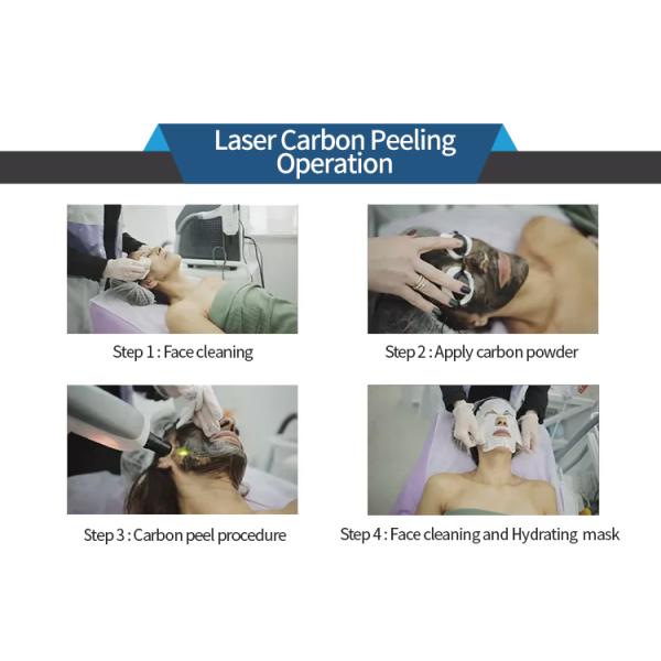 Tuv Approved Laser Tattoo Removal Equipment Q Switched Nd Yag For Beauty Salon