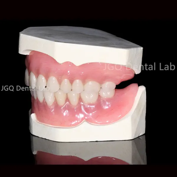 Permanent Restoration Full Contour Zirconia Crown Dental Implant with Custom Milled Titanium Frame